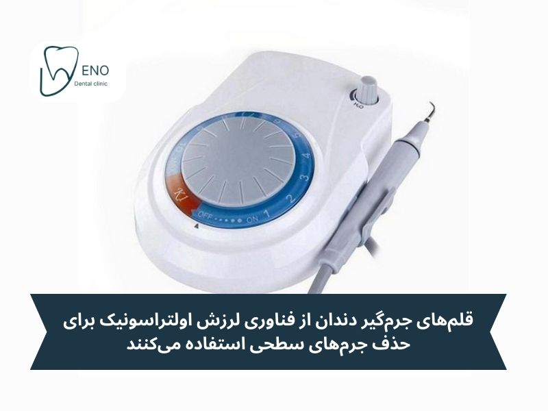 جرم گیری با دستگاه جرم گیری دندان خانگی: آیا مؤثر است؟