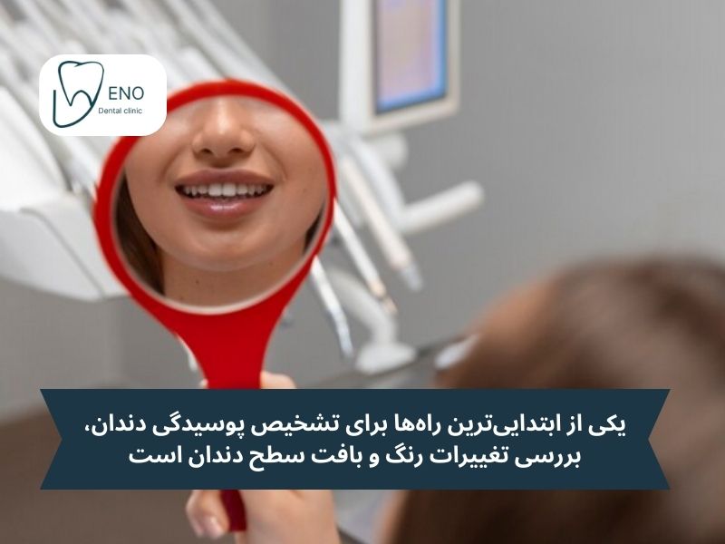 روشهای کاربردی برای تشخیص پوسیدگی دندان در خانه