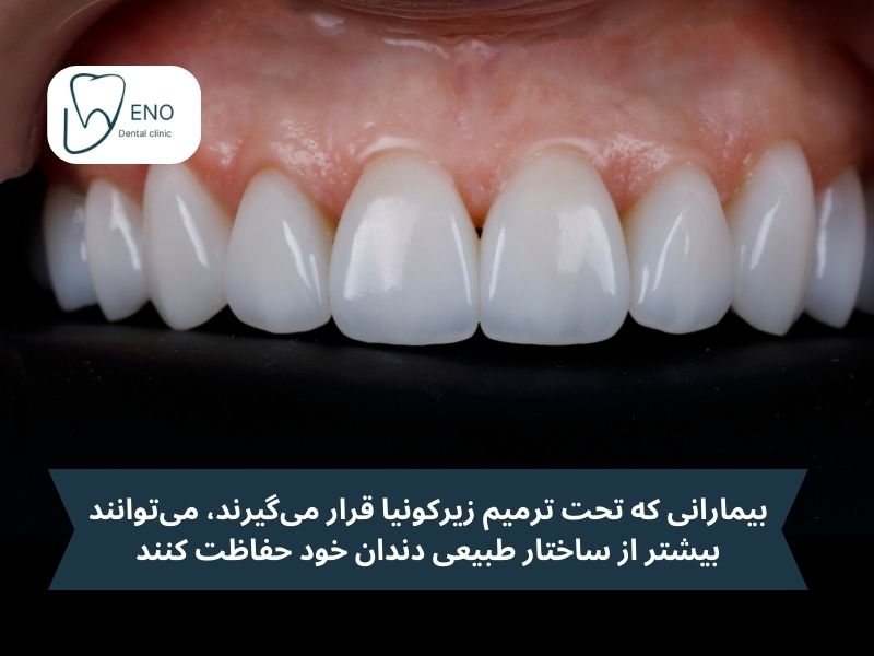 زیرکونیا در مقابل تاجهای سرامیکی