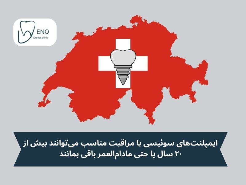 طول عمر ایمپلنت سوئیسی