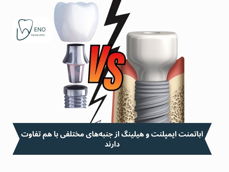 فرق هیلینگ و اباتمنت