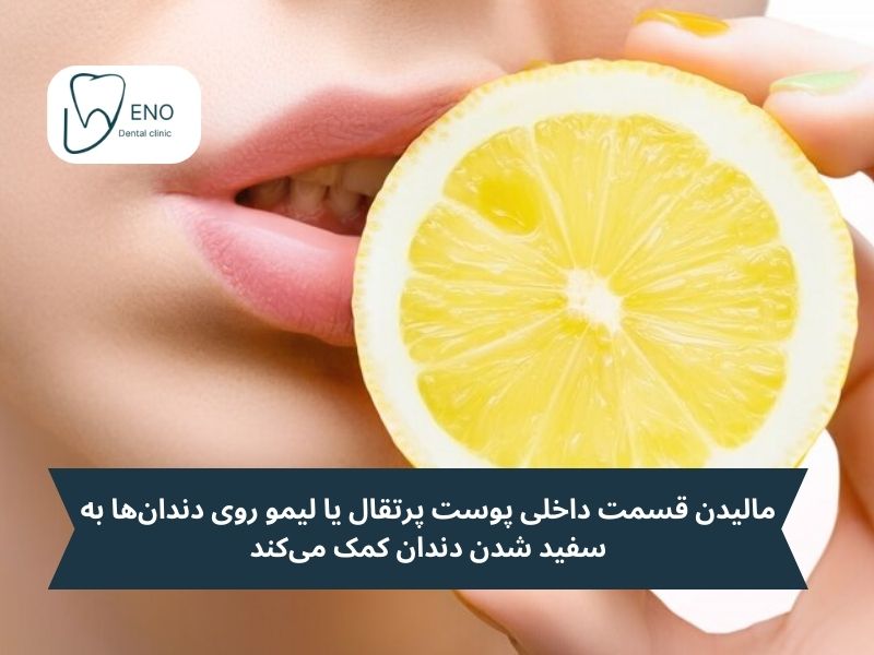 مالیدن قسمت داخلی پوست پرتقال یا لیمو روی دندانها