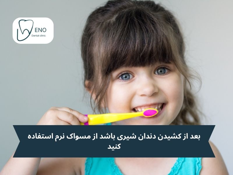 مراقبتهای مهم بعد از کشیدن دندان شیری