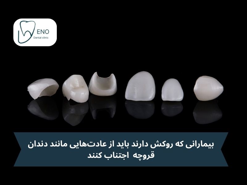 مراقبت و نگهداری مناسب عامل اصلی افزایش ماندگاری روکش زیرکونیا