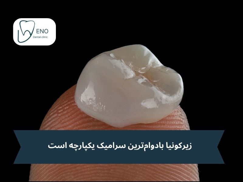 مزایای کلیدی روکشهای زیرکونیا