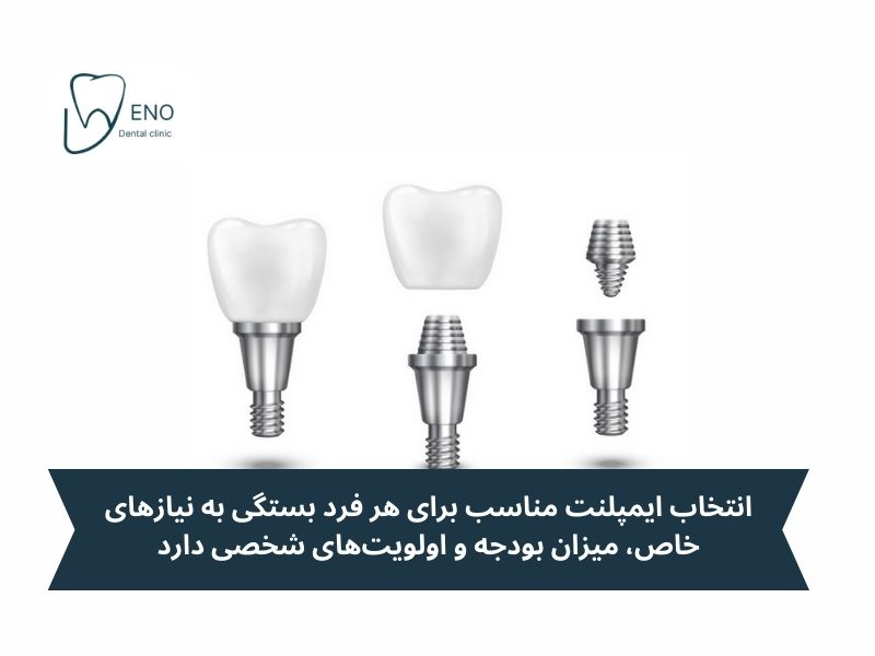 مقایسه ایمپلنت سوئیسی با ایمپلنتهای کرهای و آمریکایی