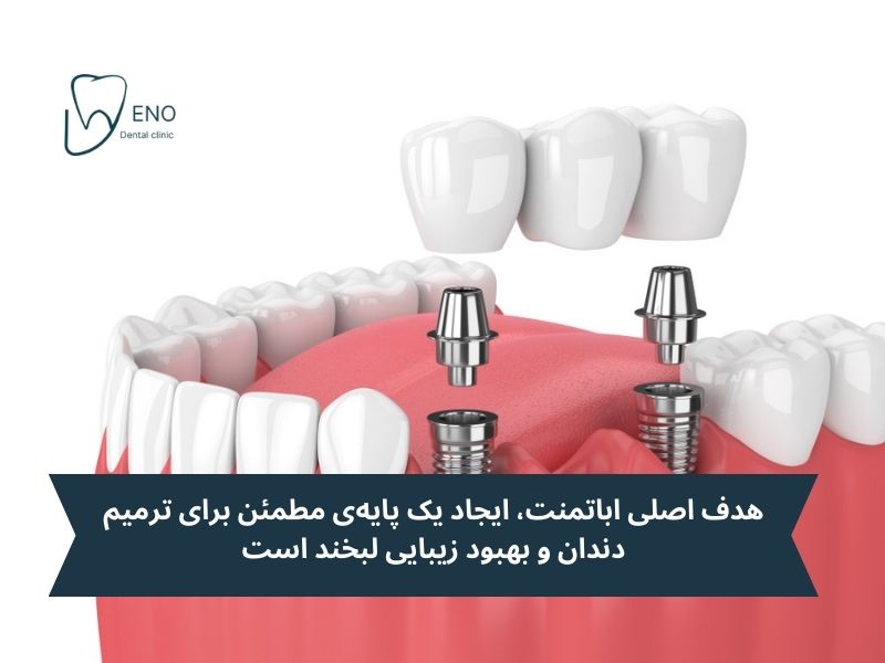 هدف اصلی اباتمنت ایمپلنت