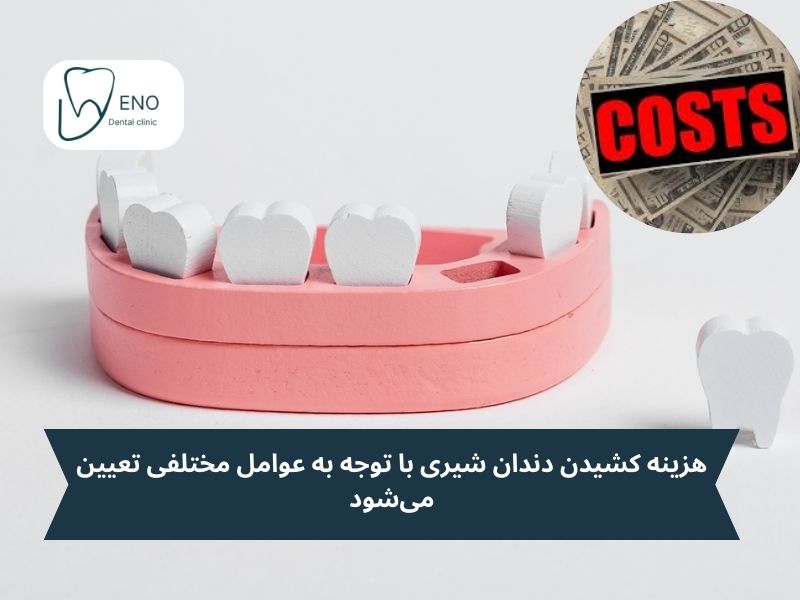 هزینه کشیدن دندان شیری