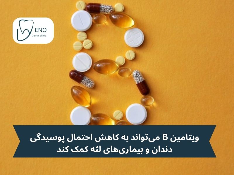 ویتامین B؛ کاهش دهنده احتمال پوسیدگی دندان و بیماریهای لثه در کودکان