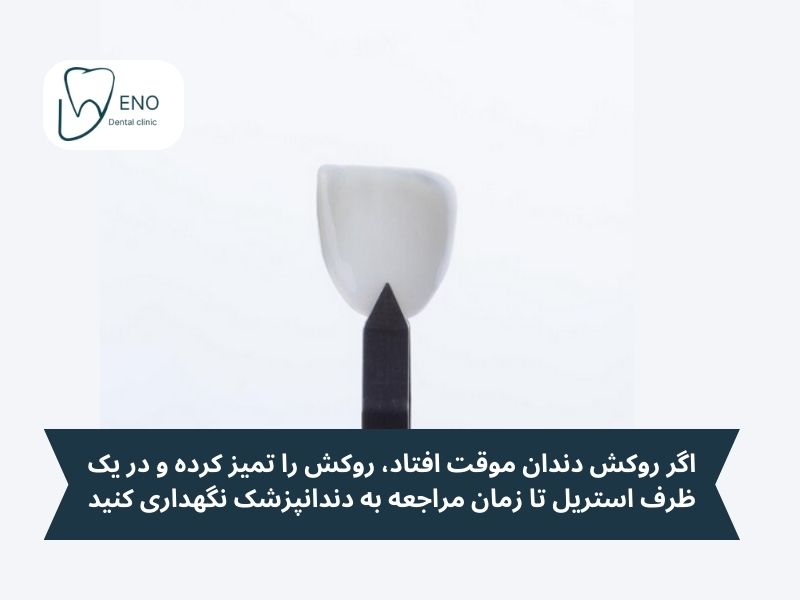 چالشها و مشکلات رایج روکش موقت دندان