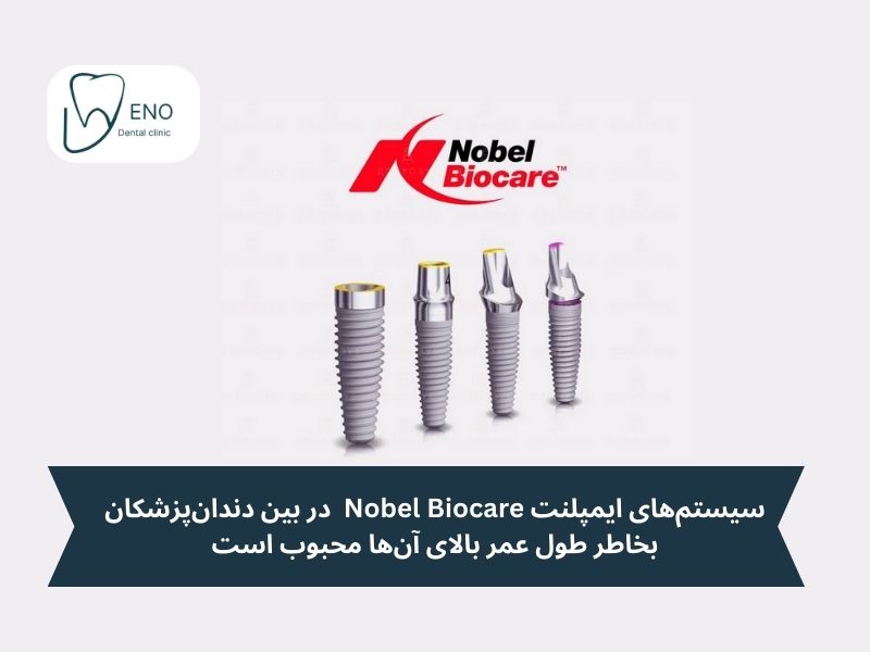ایمپلنتهای Nobel Biocare: کیفیت بینظیر و طول عمر بالا