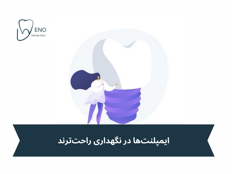 فرق اوردنچر با ایمپلنت از نظر نگهداری و بهداشت
