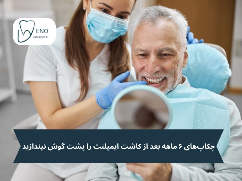 مراقبتهای بعد از کاشت ایمپلنت osstem