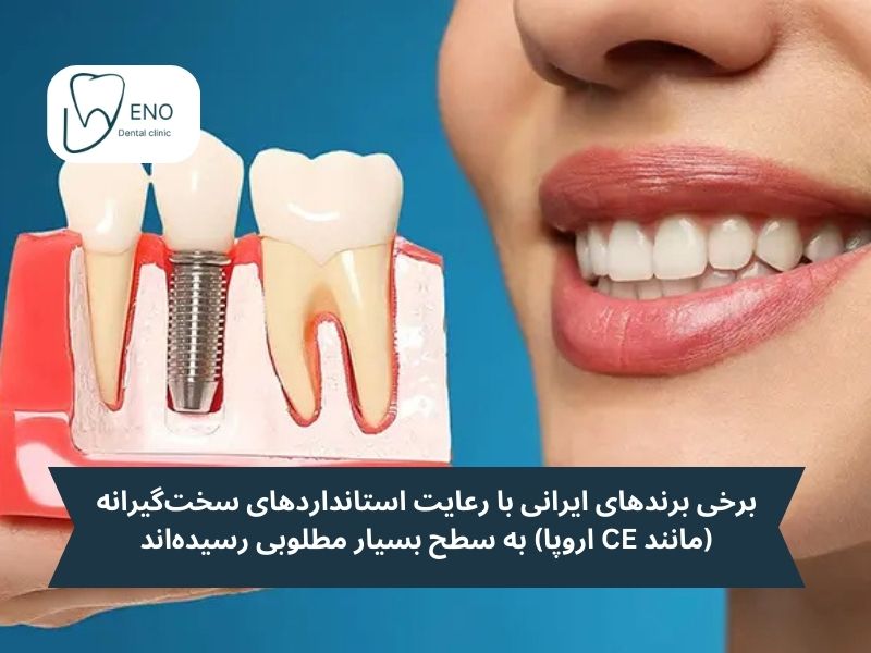 مقایسه میان ایمپلنت ایرانی و برندهای خارجی