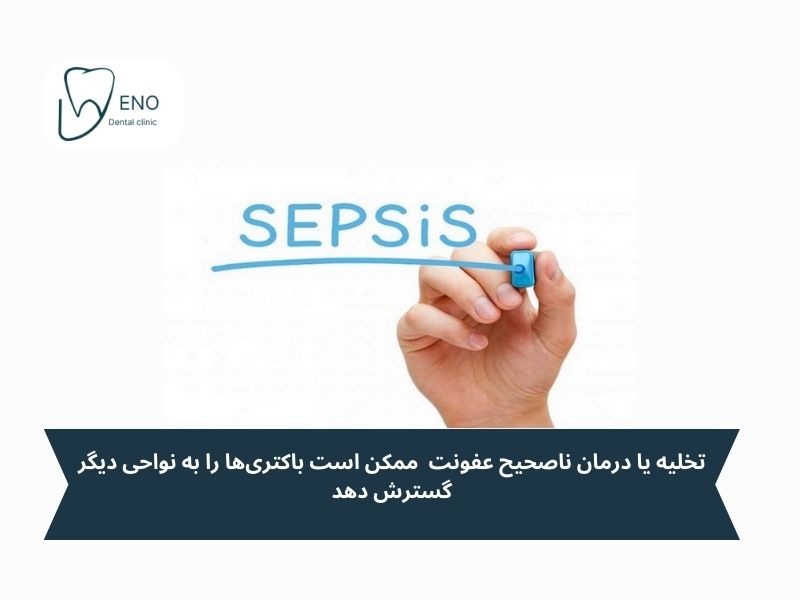 چگونه عفونت دندان را خارج کنیم؟ 5 مرحله حیاتی که باید بدانید!