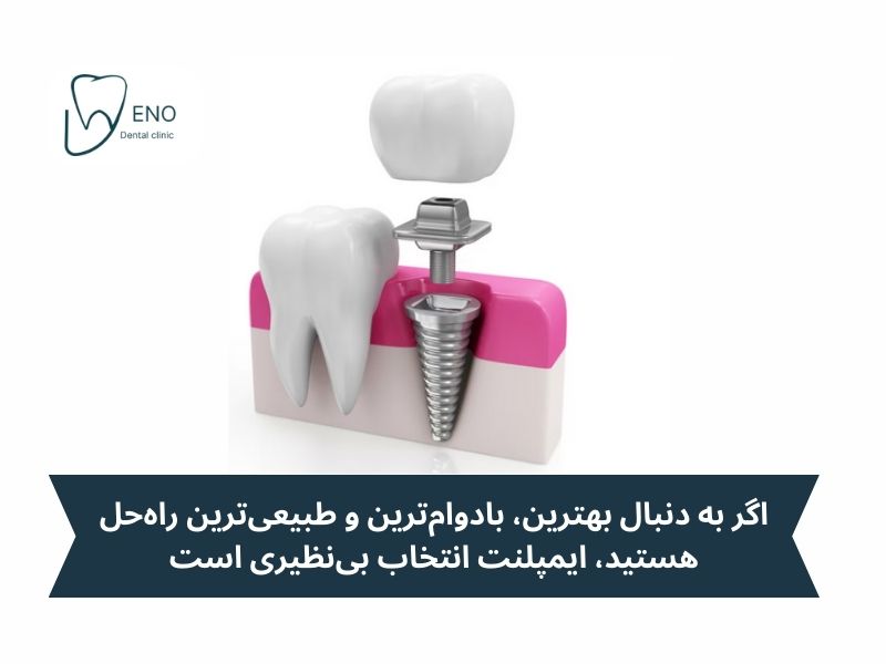 کدام گزینه برای شما بهتر است؟ اوردنچر با ایمپلنت
