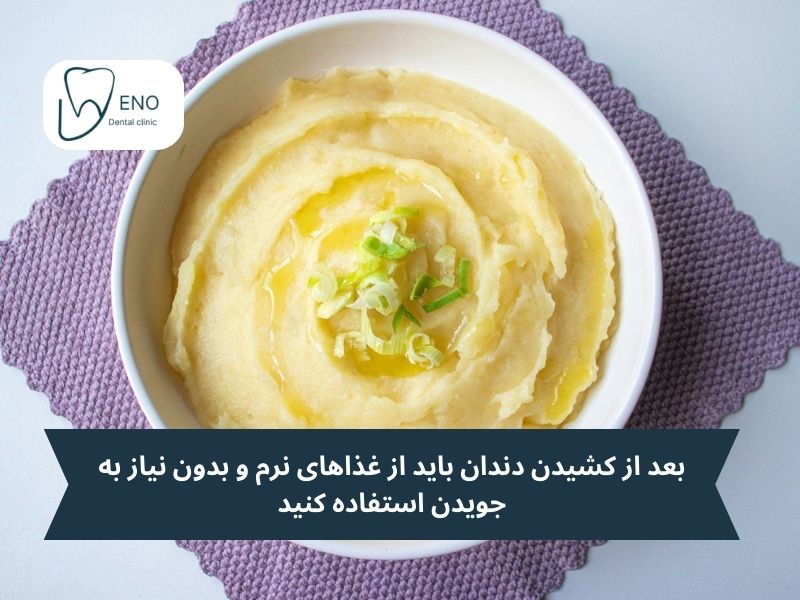 2 روز ابتدایی بعد از کشیدن دندان