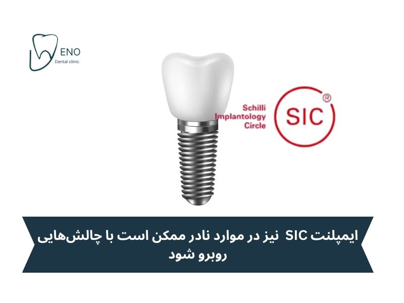 آیا ایمپلنت SIC هم عوارض دارد