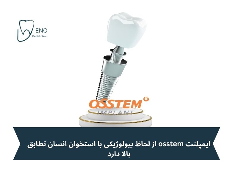بررسی مزایای علمی و عملی ایمپلنت اوستم