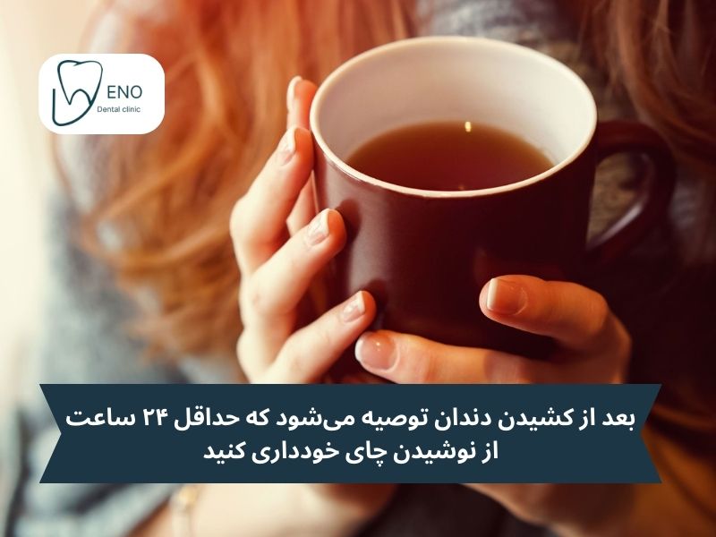 خوردن چایی بعد از کشیدن دندان