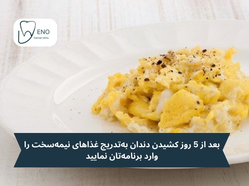 رژیم تغذیه ای بعد از کشیدن دندان