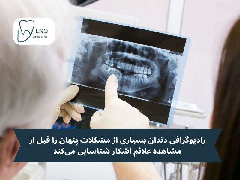 ضرورت انجام رادبوگرافی دندان