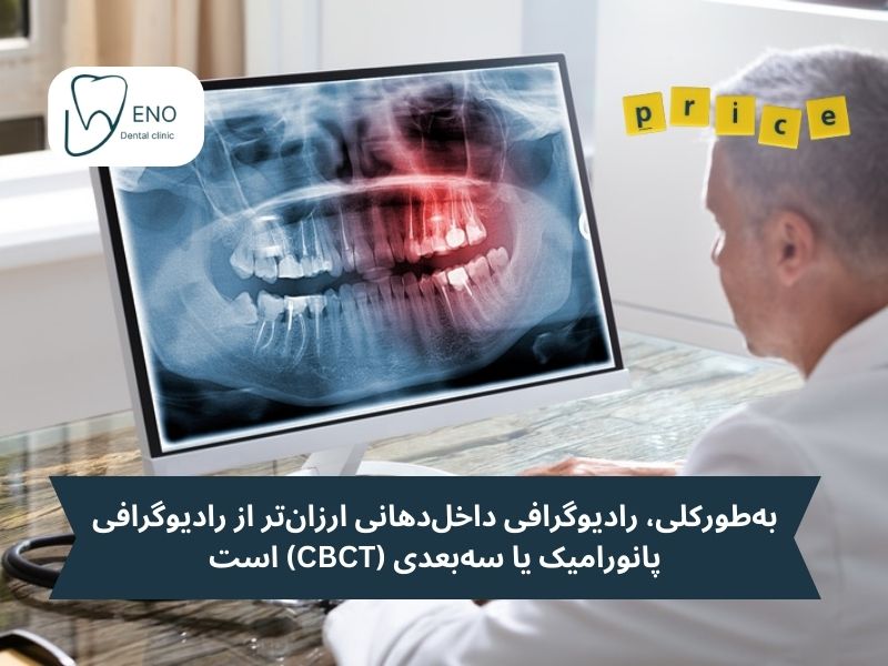 قیمت عکس رادیولوژی دندان