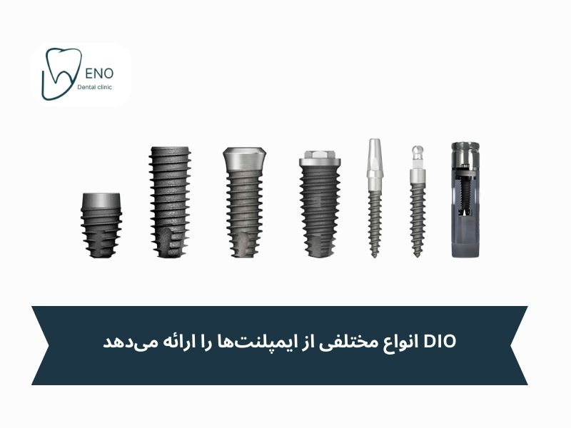 مزایای ایمپلنت دیو