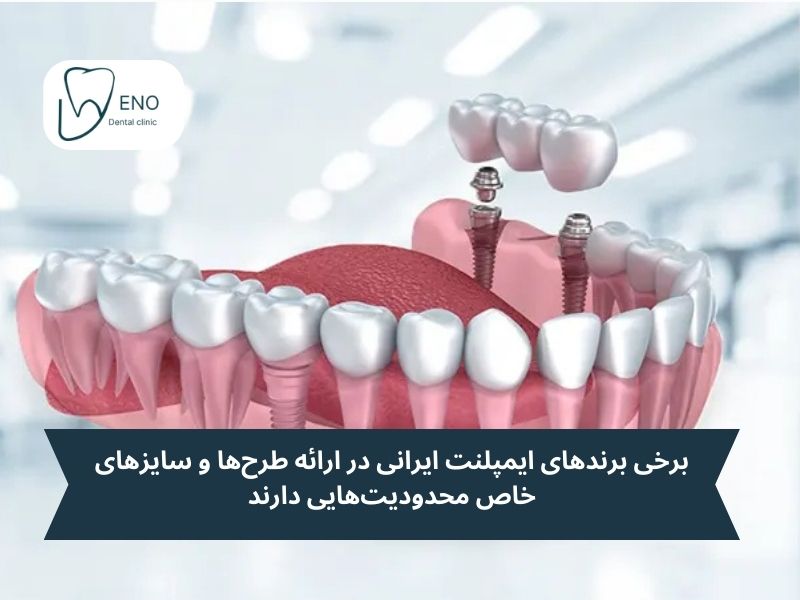 معایب ایمپلنت ایرانی