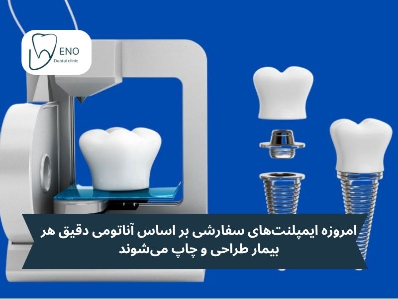 ایمپلنتهای سفارشی با استفاده از پرینت سه بعدی