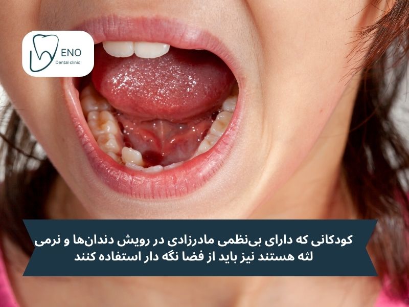 کودکانی که دارای بی‌نظمی مادرزادی در رویش دندان‌ها و نرمی لثه هستند نیز باید از فضا نگه دار استفاده کنند