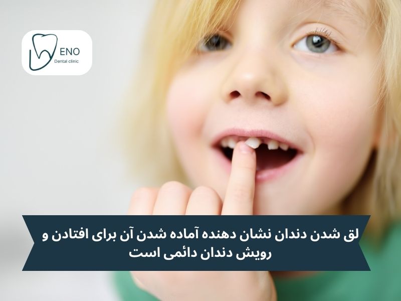 لق شدن دندان شیری