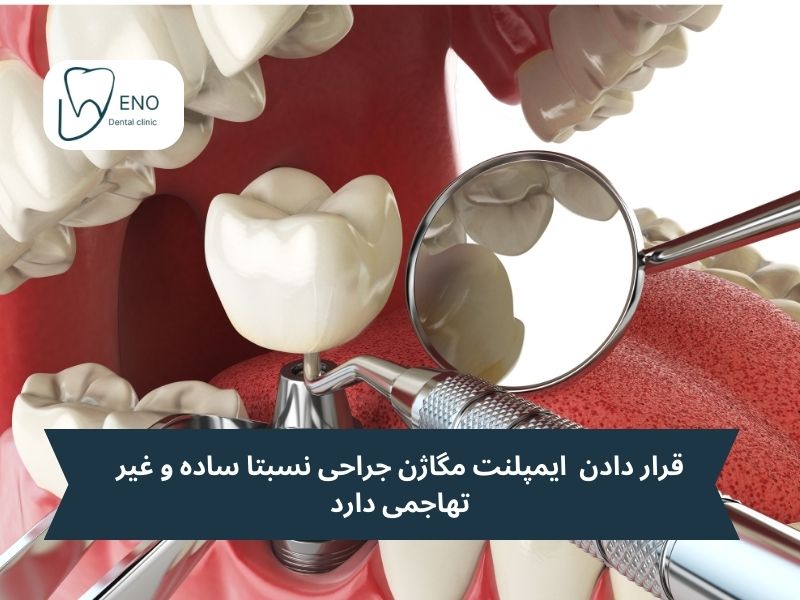 قرار دادن ایمپلنت مگاژن جراحی نسبتا ساده و غیر تهاجمی دارد