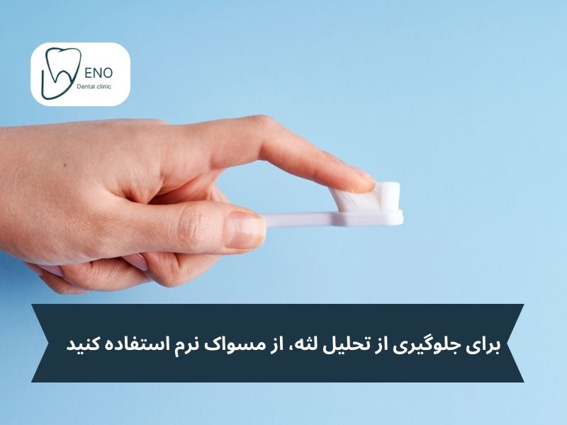 برای جلوگیری از تحلیل لثه، از مسواک نرم استفاده کنید