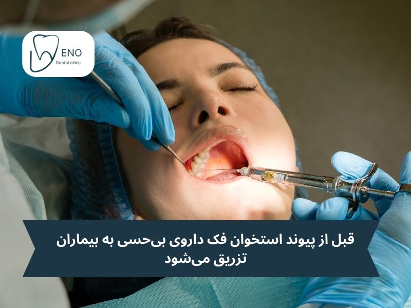 بی حس کردن دندان