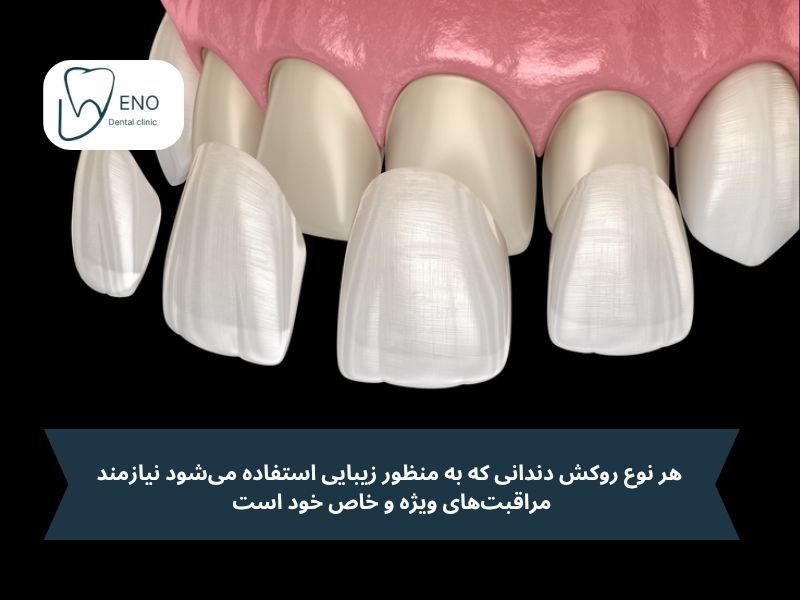 مراقبتهای بعد از انجام کامپوزیت سرامیکی
