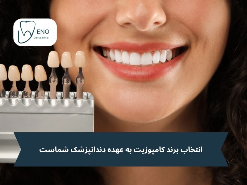 انتخاب برند کامپوزیت به عهده دندانپزشک شماست