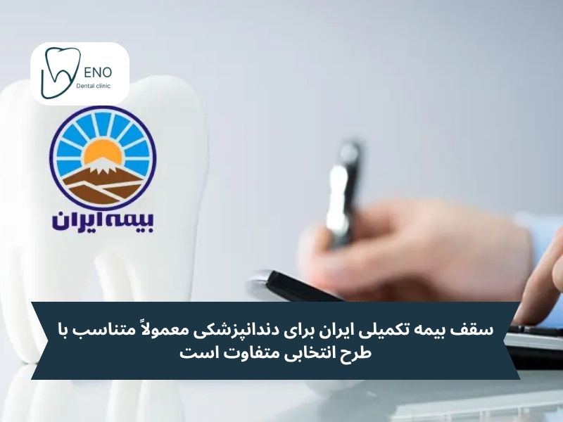 بیمه تکمیلی ایران برای دندانپزشکی