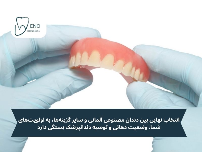 دندان مصنوعی آلمانی در مقابل سایر گزینه‌ها؛ یک مقایسه هوشمندانه برای بهترین انتخاب!