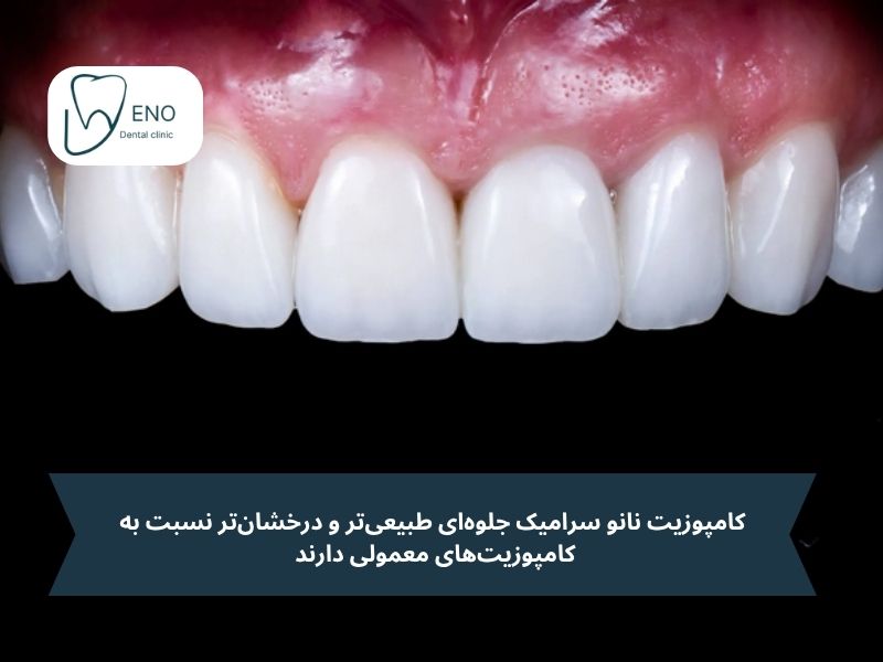 فرق کامپوزیت با نانو سرامیکی در چیست