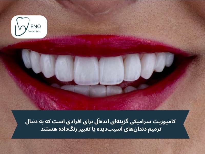 کامپوزیت سرامیکی برای چه کسانی مناسب است