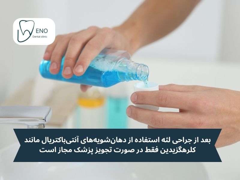 بهداشت دهان بعد از جراحی لثه