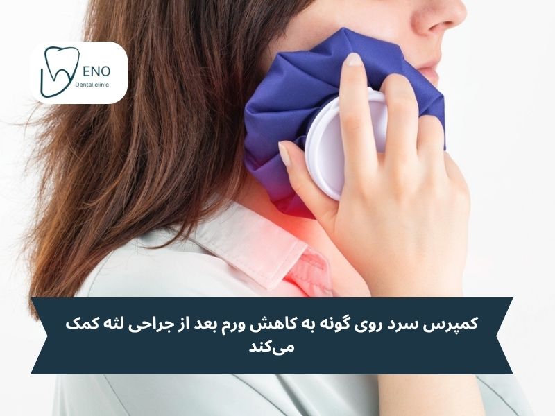 مراقبت بعد از جراحی لثه