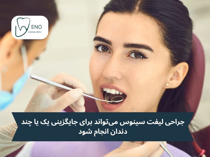 چه کسانی کاندیدای مناسبی برای جراحی سینوس لیفت هستند