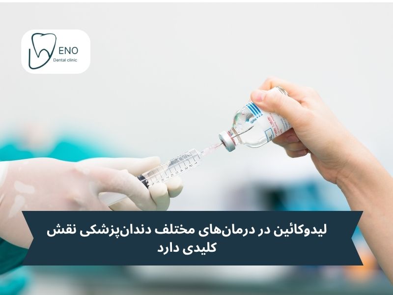لیدوکائین در درمانهای مختلف دندانپزشکی نقش کلیدی دارد