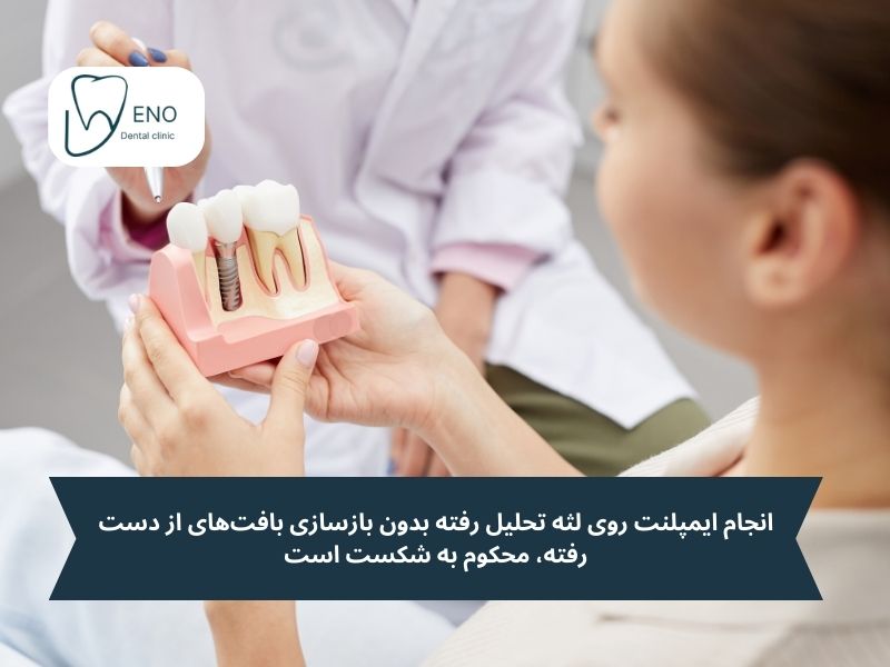 آیا میتوان ایمپلنت روی لثه تحلیل رفته انجام داد