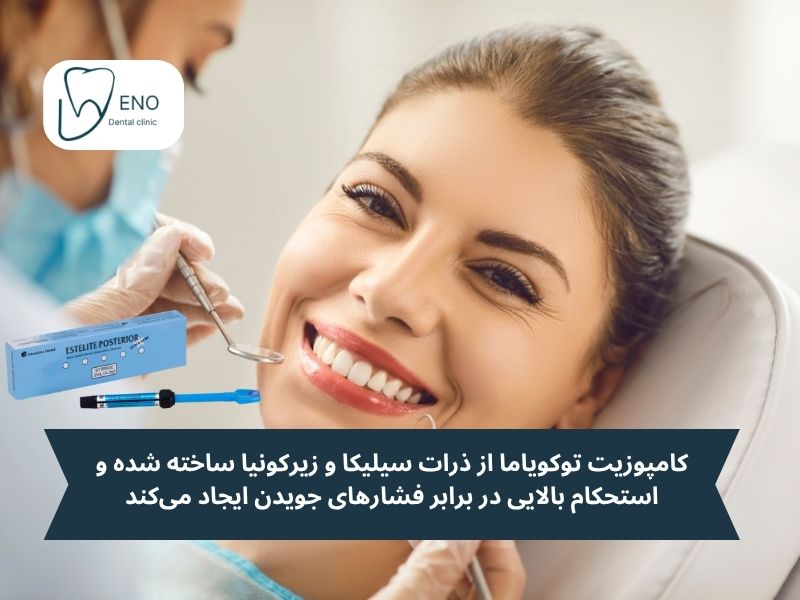 ترکیبات کامپوزیت توکویاما