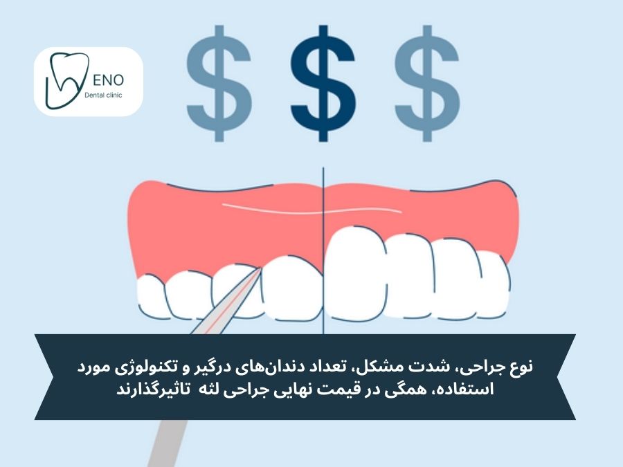 رمزگشایی از هزینهها؛ جدول قیمت انواع جراحی لثه