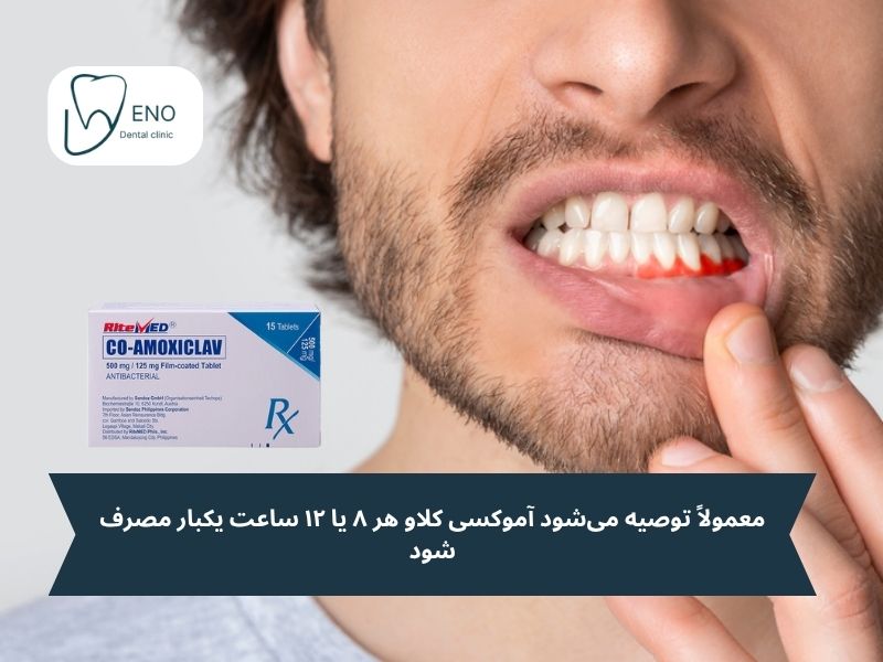 زمانبندی مصرف آموکسی کلاو برای عفونت دندان