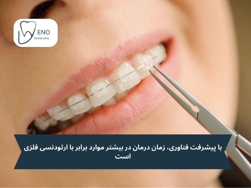 طول درمان در ارتودنسی سرامیکی؛ آیا کندتر است